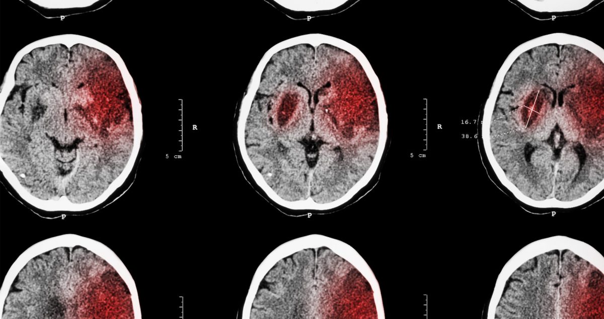 Vasculature of the Head | Texas Heart Institute