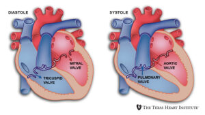 Heart Valves | The Texas Heart Institute®