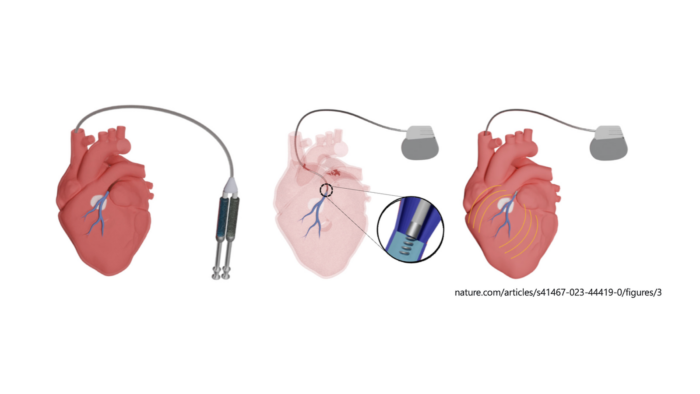 The Latest Newsroom | The Texas Heart Institute®