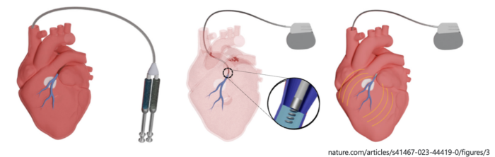 Injectable Hydrogel Electrodes Open Door to a Novel Painless Treatment ...